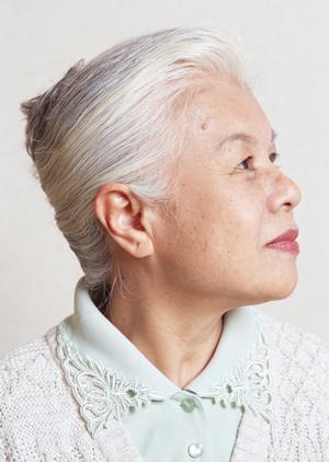 大分市の皮膚科専門医で安心の診察を